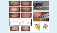 CORSO INTRODUTTIVO FUNCTION DRIVEN ORTHODONTICS + CORSO PIEGATURA GUMMETAL 7 E 8 FEBBRAIO